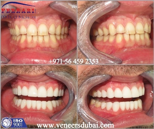 Case 1-002