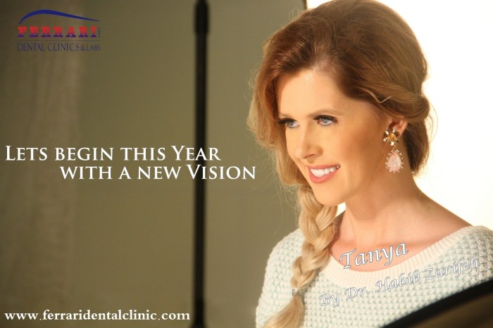 Tanya-hollywood-smile-by-Dr-Habib-zarifeh